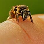 تحقیق-آلرژى-نسبت-به-زنبور-گزیدگی-و-روشهای-درمان