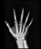رادیوگرافی انگشتان دست
