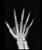 رادیوگرافی انگشتان دست